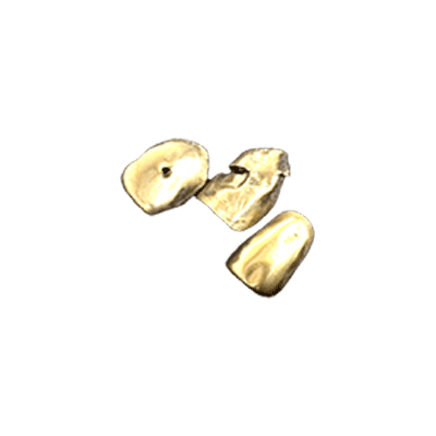 金歯